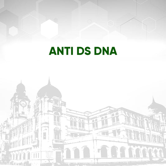 Anti Ds DNA