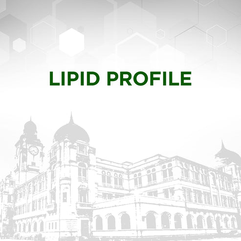 Lipid Profile Test – KMC Labs