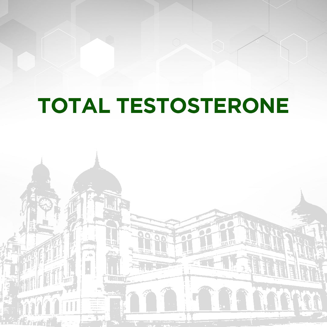 Total Testosterone Test