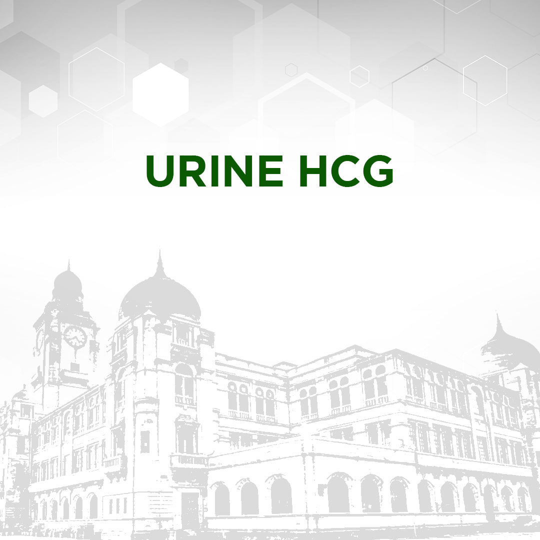 Urine HCG Test