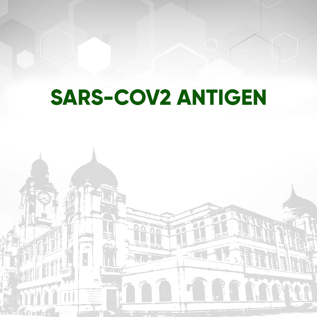 Sars-Cov2 Antigen